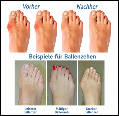 Lunessa | Orthopädische Sandalen mit unterstützender Komfortsohle